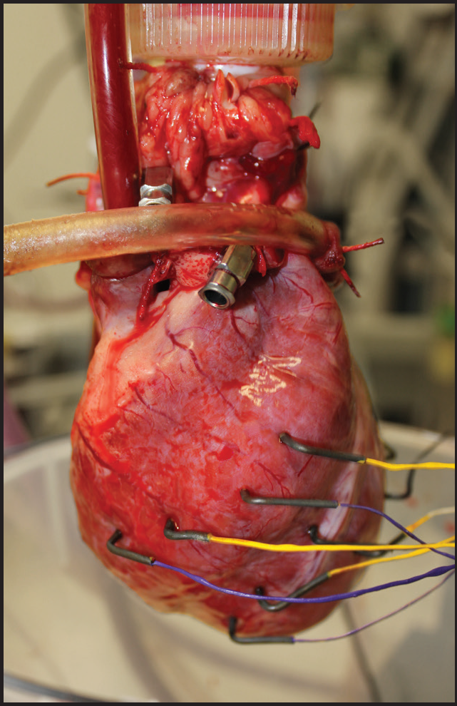 At the Heart of VF - Nathaniel Rhodes